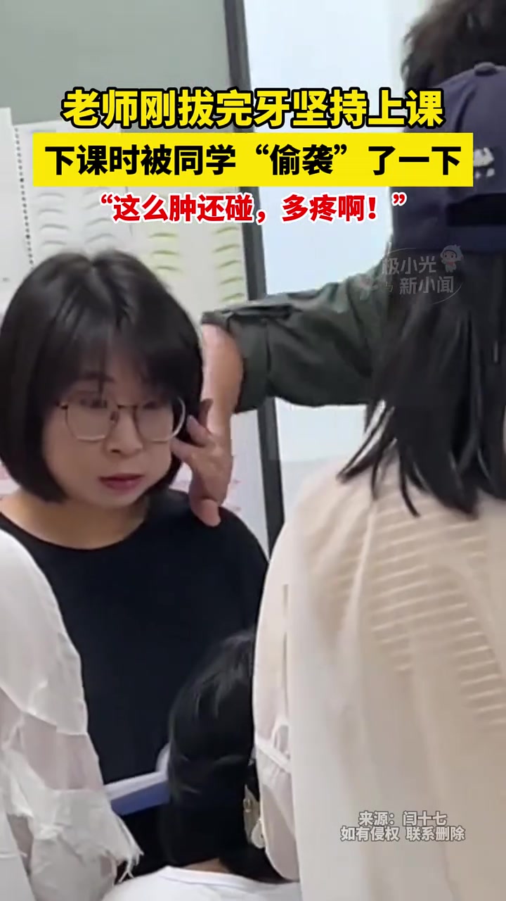 这么肿还碰！下课时肿脸老师被同学偷袭了一下