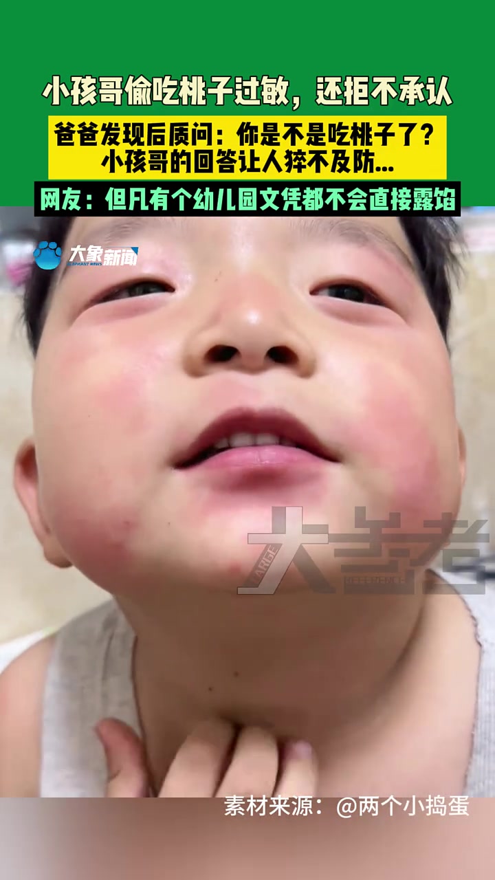 小孩哥偷吃桃子过敏，小孩哥的回答让人猝不及防..