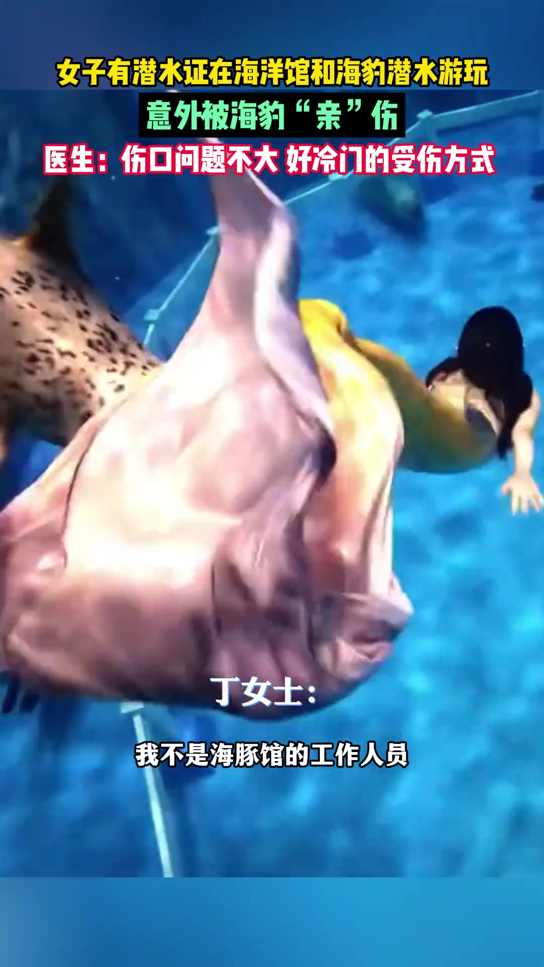 女子在海洋馆体验和海豹潜水游玩，意外被海豹“亲”伤！