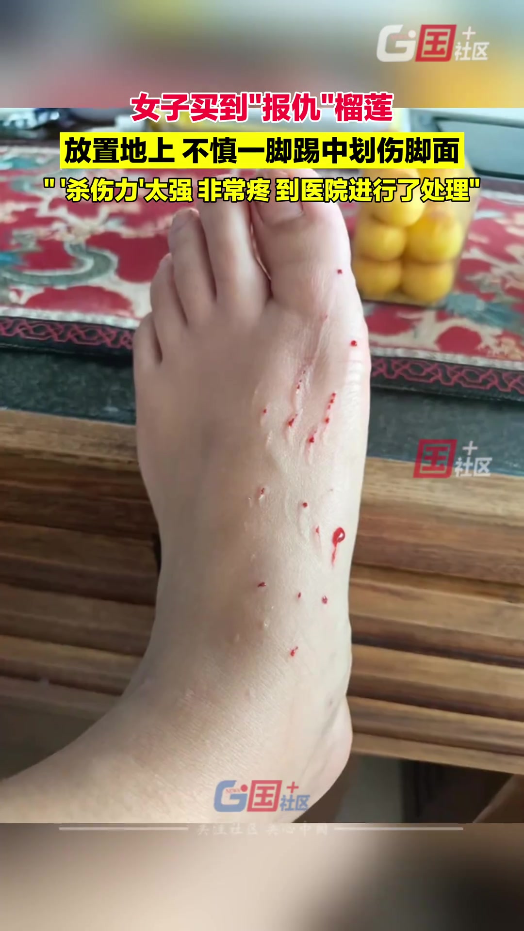 女子一脚踢到榴莲，一看这榴莲就是来“报仇”的