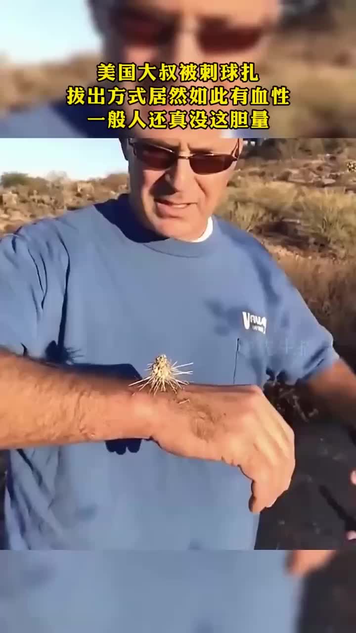美国大叔被刺球扎，拔出方式居然如此有血性，一般人还真没这胆量