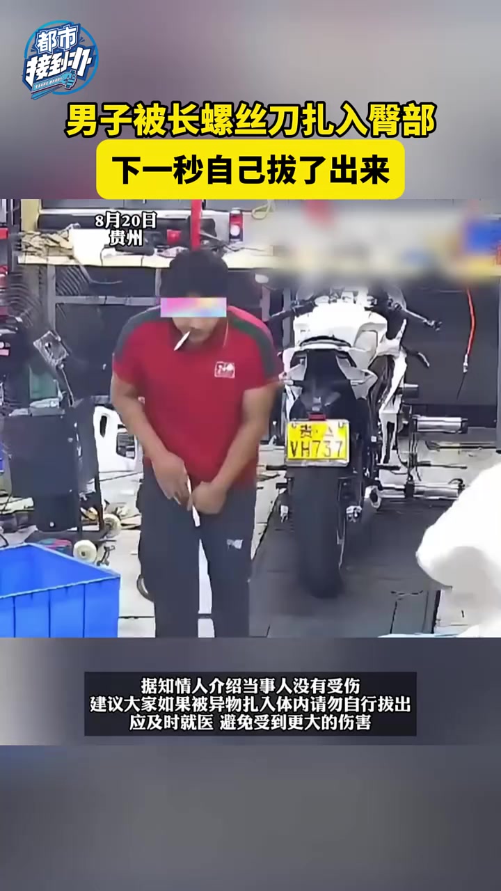 男子被长螺丝刀扎入臀部，下一秒自己拔了出来，看着都疼！
