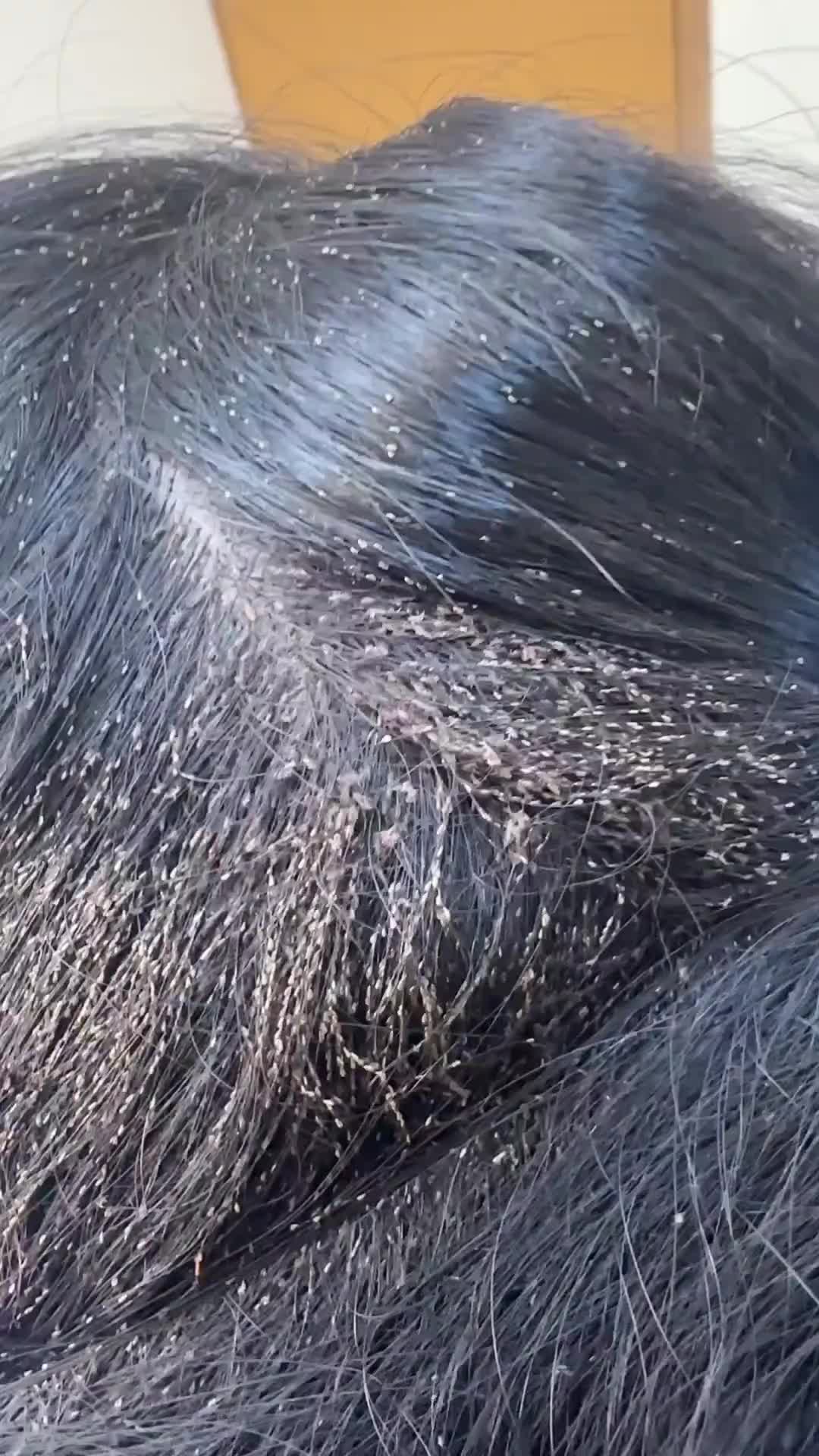 这是去干啥了头发能弄成这样，都可以去开小型生物动物园了