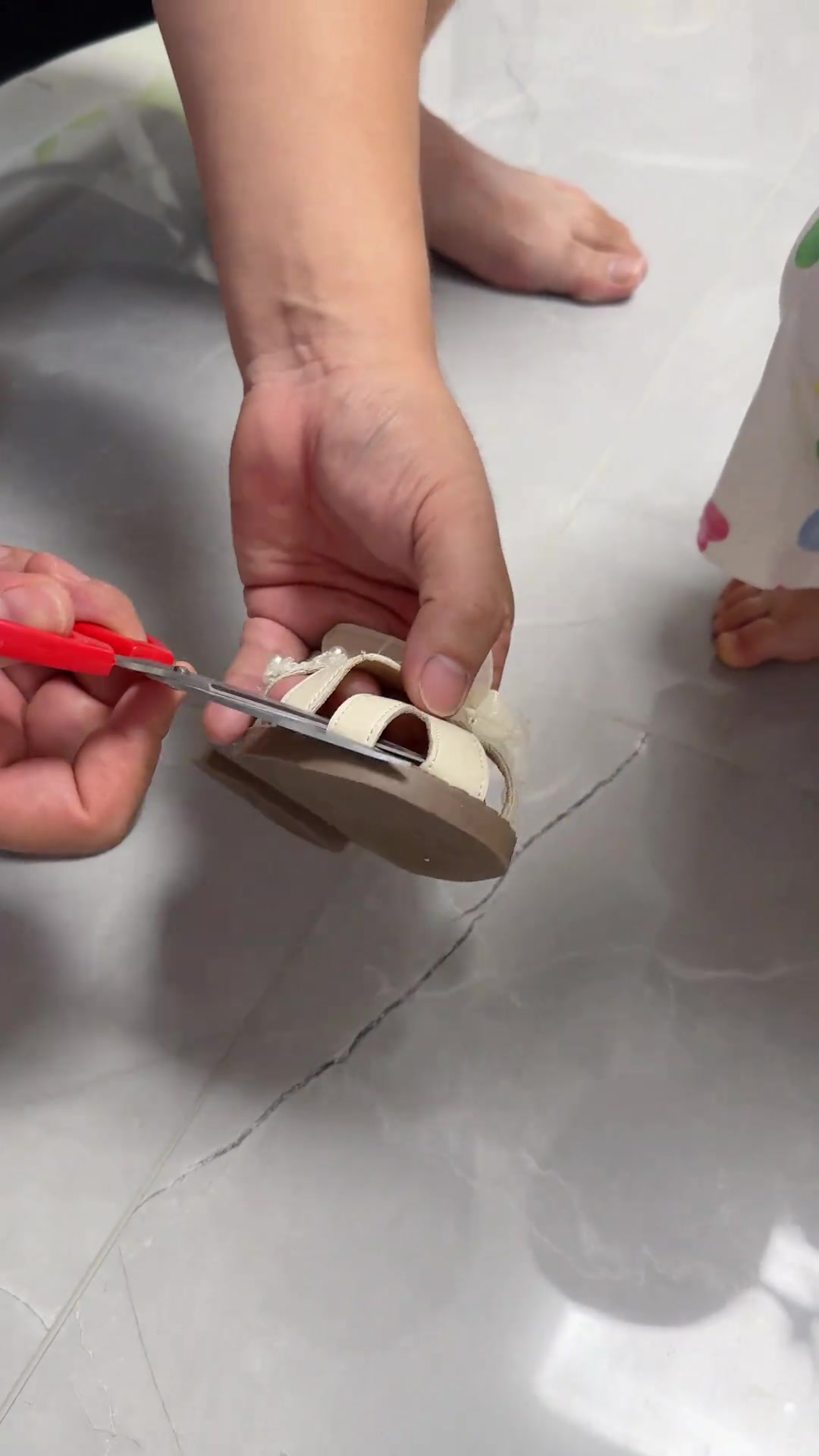 剪掉的部分别扔了，等有二胎了再缝上