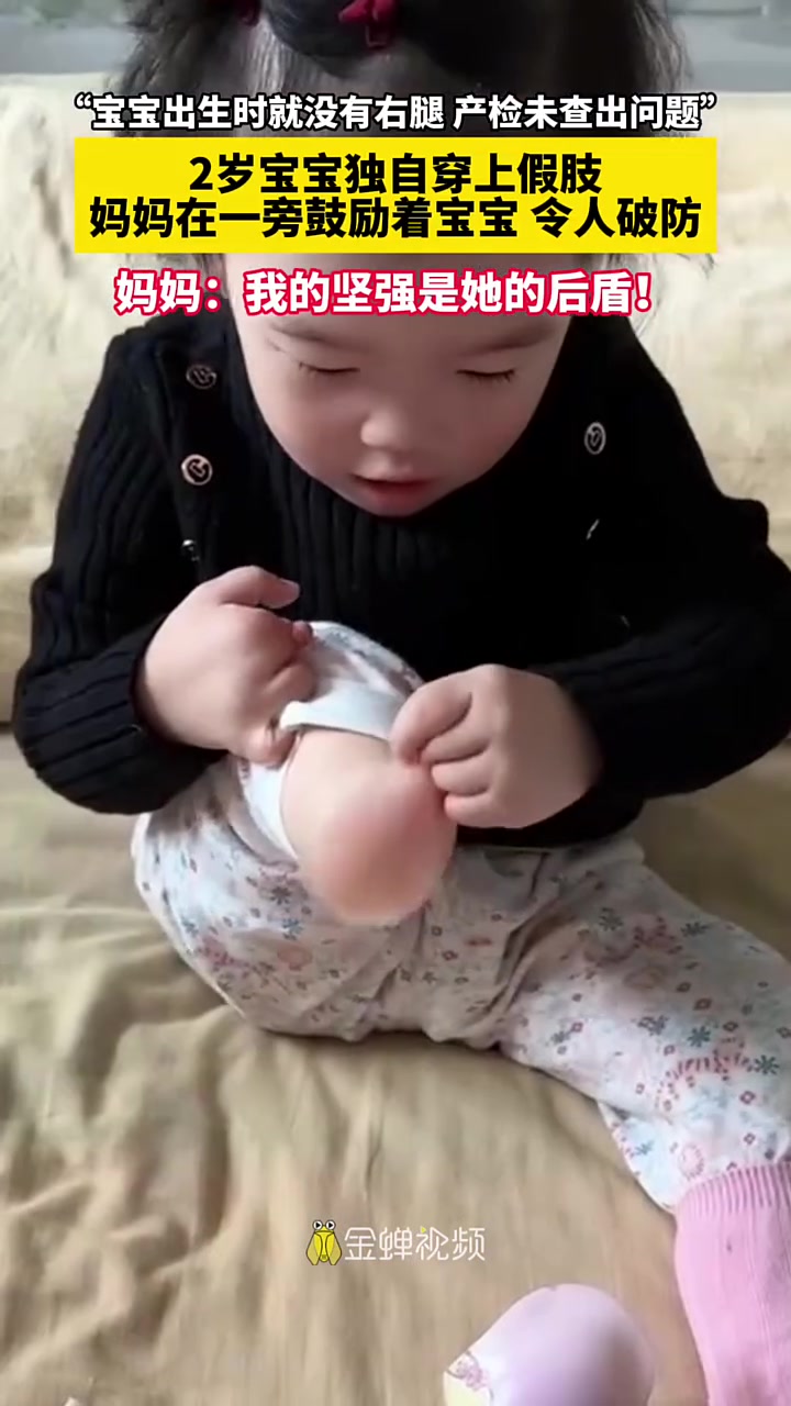 2岁宝宝独自穿上假肢，妈妈在一旁鼓励着宝宝令人破防！