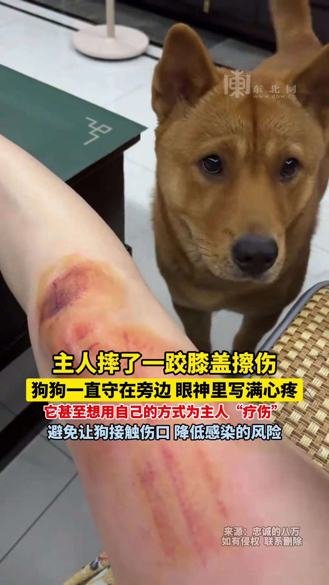 主人摔了一跤擦伤，狗子在旁边满脸心疼