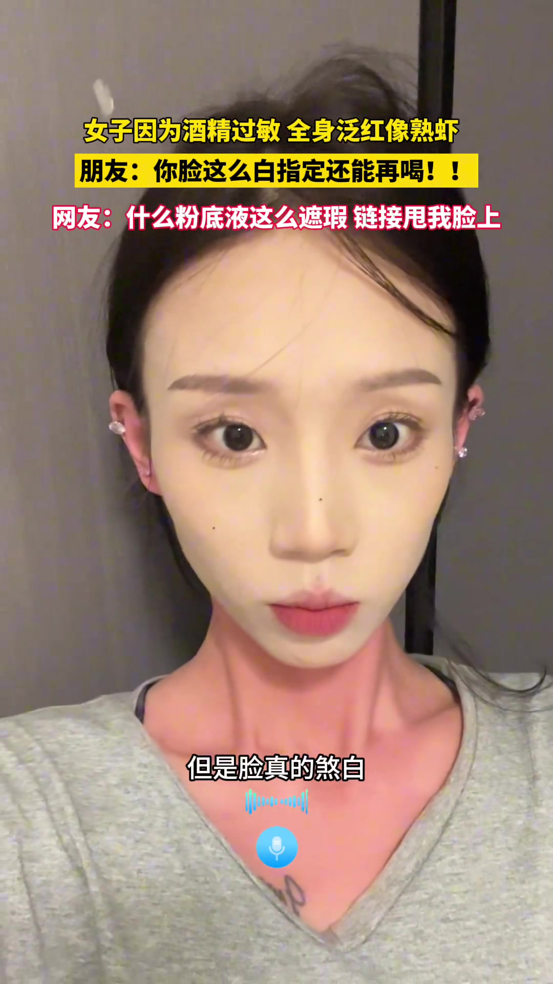 女生酒精过敏全身泛红像熟虾朋友直言：脸这么白还能喝