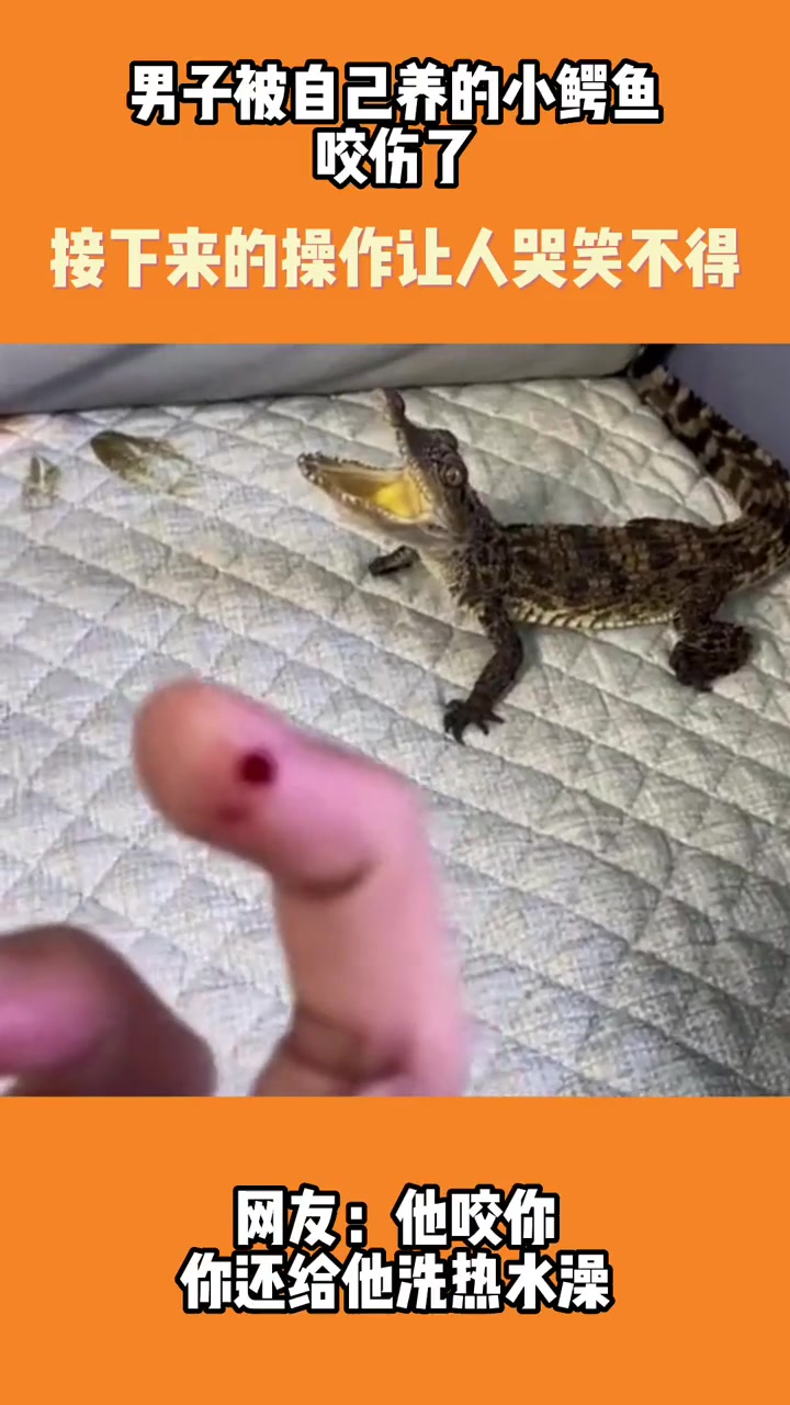 国外男子被自己养的鳄鱼咬伤了之后，接下来的操作哭笑不得！