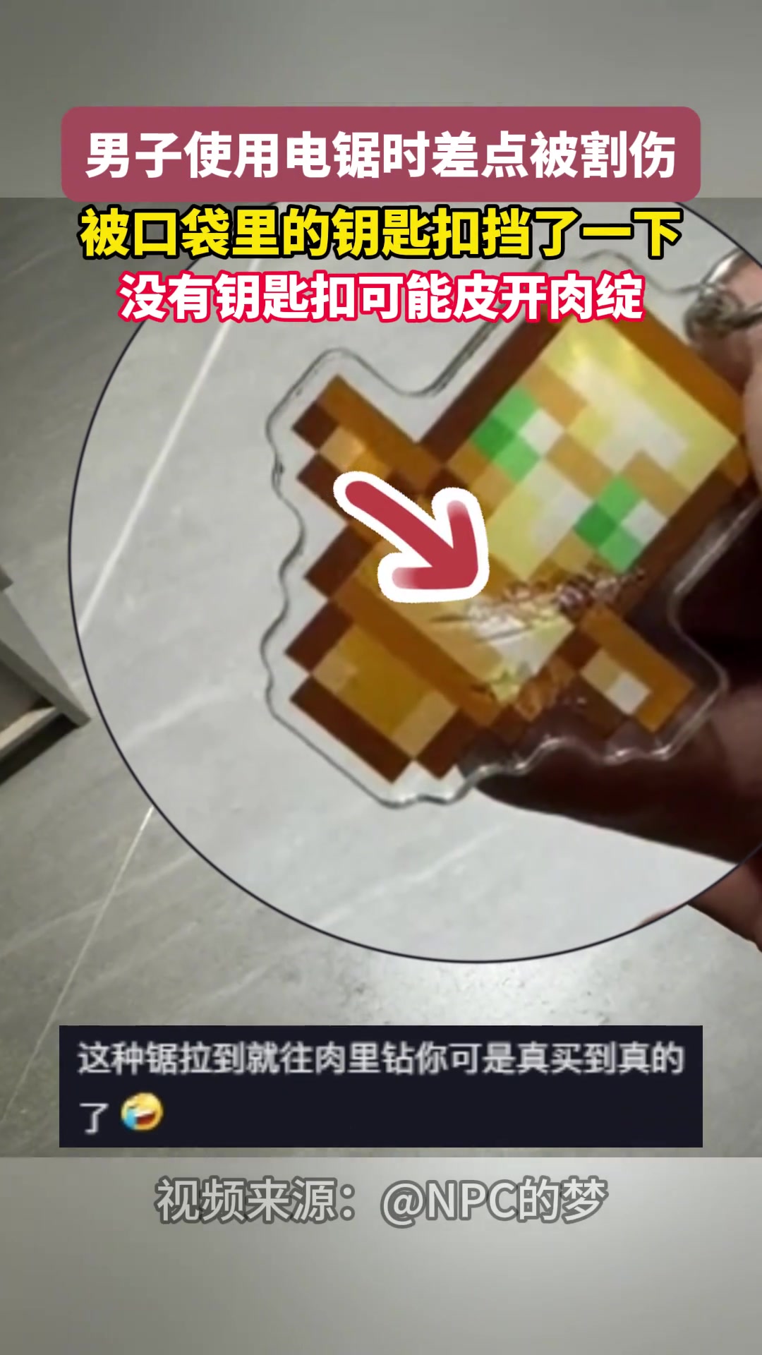 男子使用电锯时差点被割伤，被口袋里的钥匙扣挡了一下！