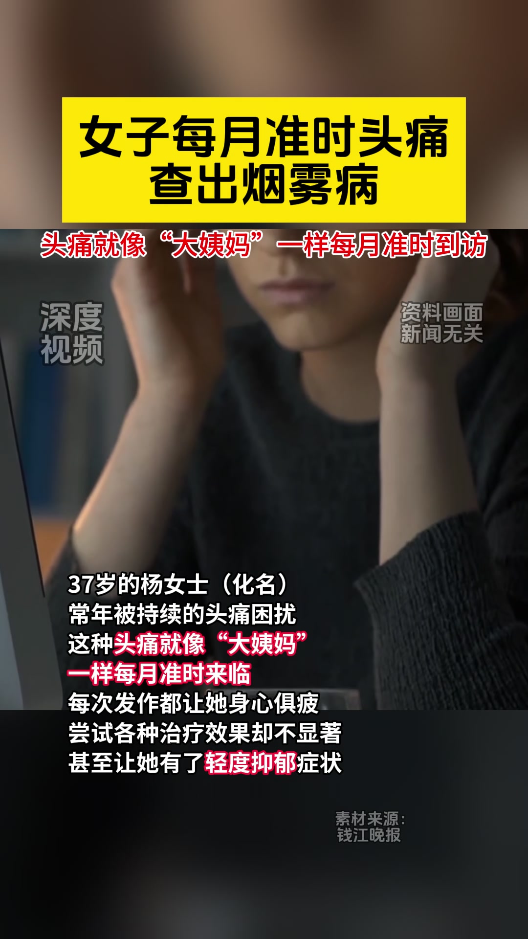 女子每月准时头痛查出烟雾病