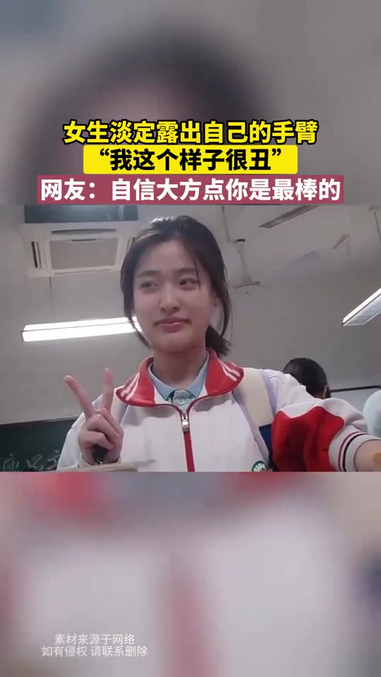 女生淡定露出手臂，“我这样子很丑”