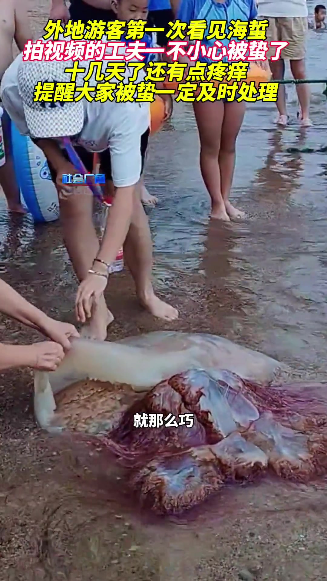 大家被海蜇垫了一定及时处理！