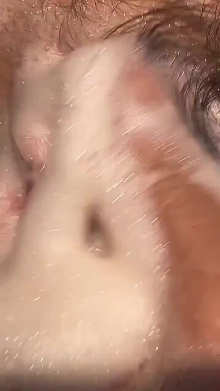 这耳朵还能要不会发炎吗