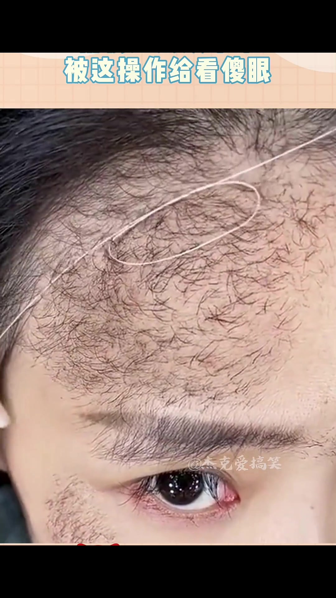 美女毛发实在旺盛，用根细线绞下来，被这操作给看傻眼！