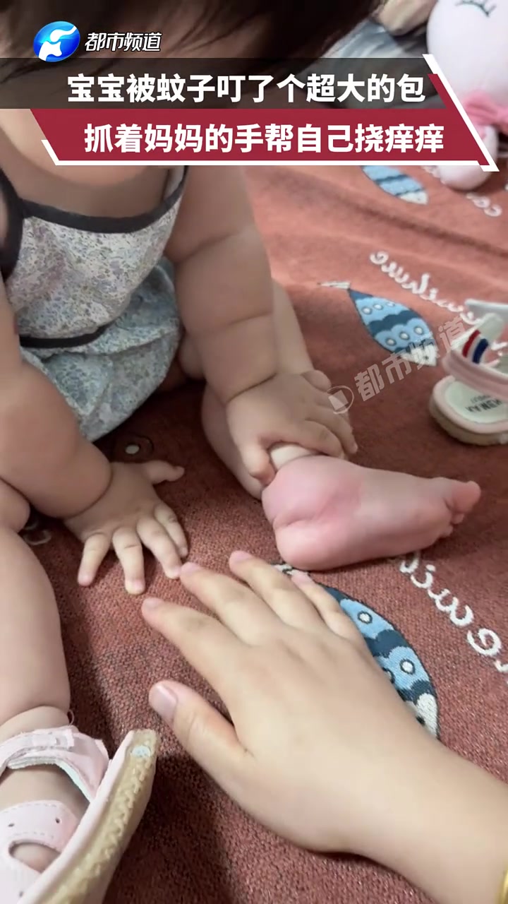 宝宝被蚊子叮了一个大包，抓着妈妈的手帮自己挠痒