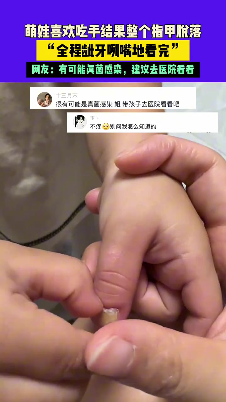 不会痛吗整个指甲盖脱落！！“全程呲牙咧嘴地看完”！
