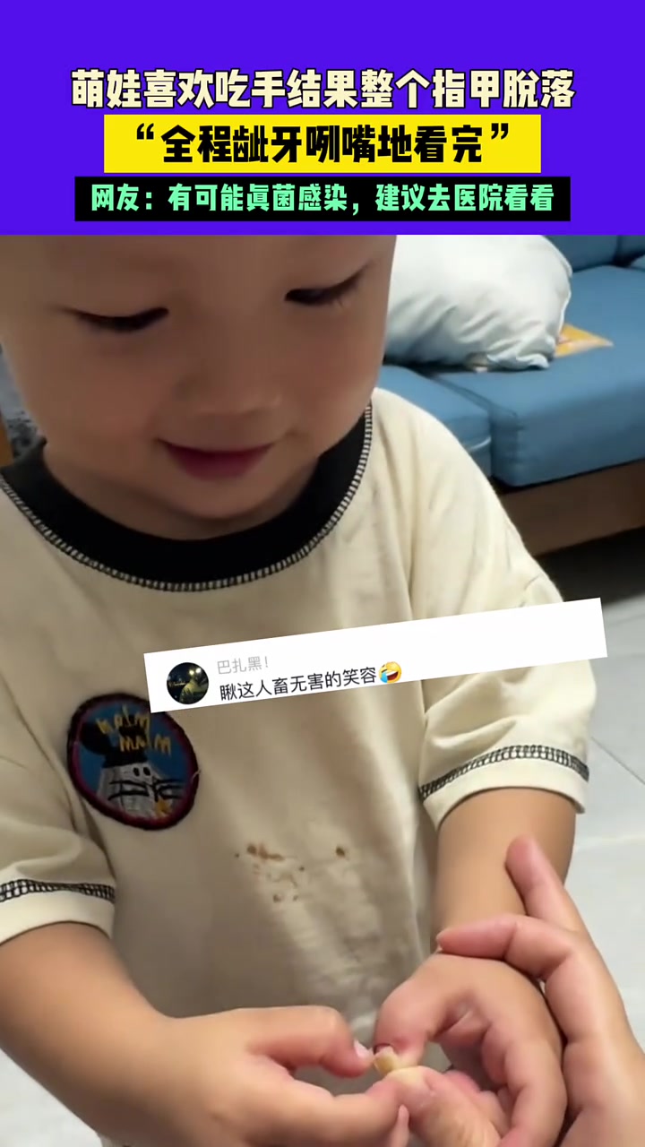 萌娃爱吃手，结果整个指甲脱落，龇牙咧嘴的看完了