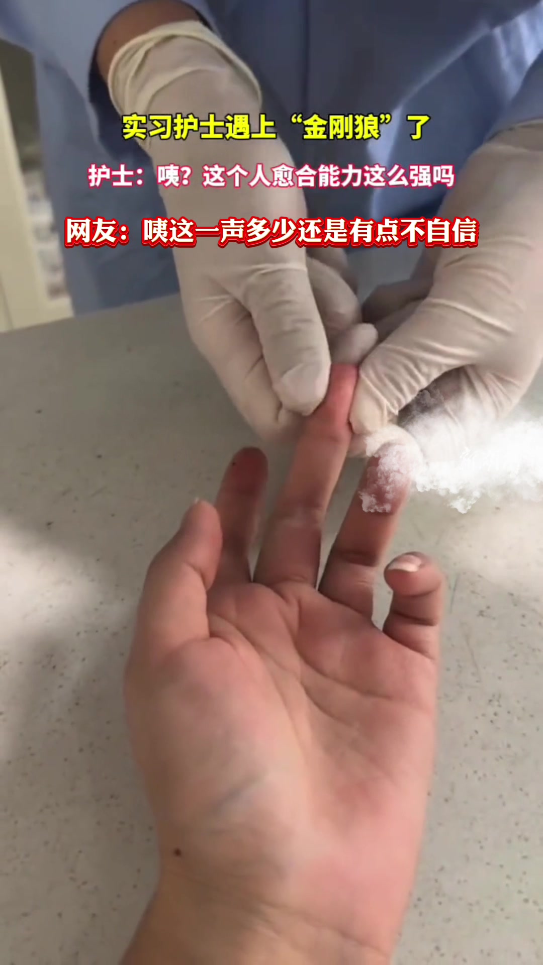 你是金刚狼还是死侍护士咦这一声多少还是有点不自信！
