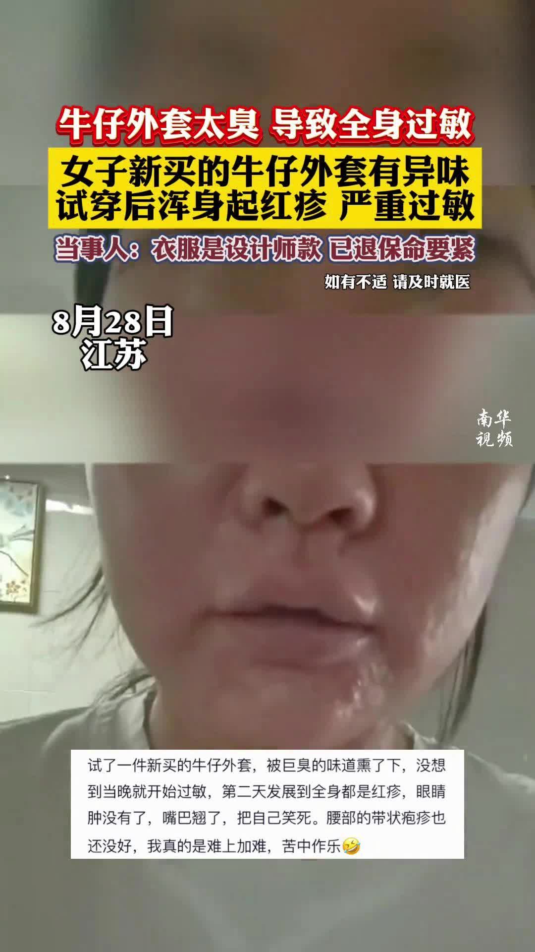 一女子买牛仔外套太臭，试穿后浑身过敏