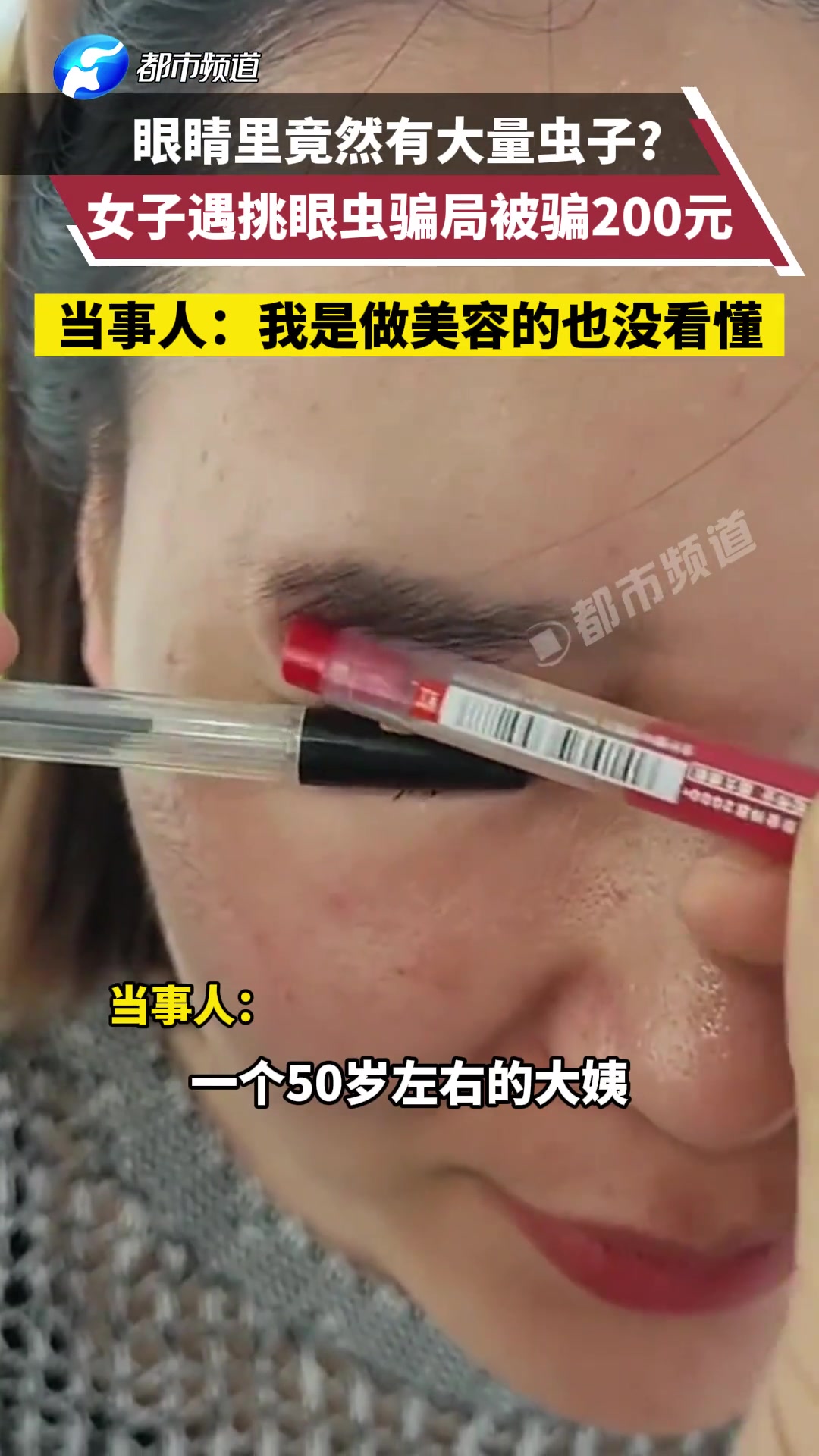 眼睛里竟然有大量虫子女子遇挑眼虫骗局被骗200元