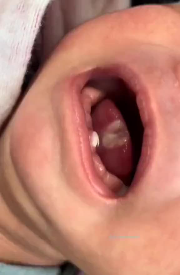 溃疡能长这么大啊这也忒恐怖了