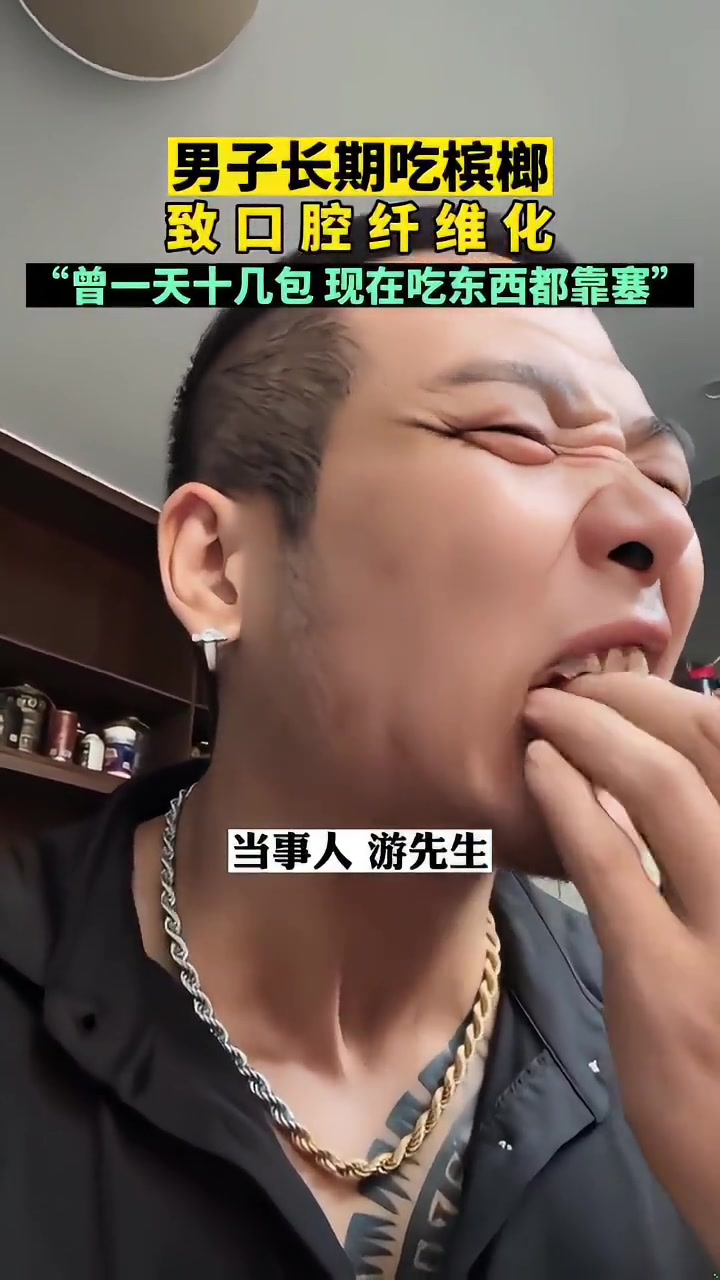 男子长期吃槟榔导致口腔纤维化，曾一天十几包，现在吃东西都靠塞