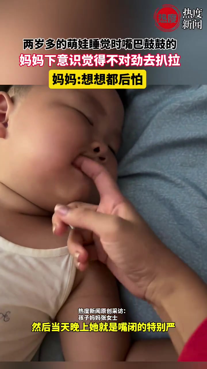 想想都后怕！两岁的萌娃睡觉时嘴巴鼓鼓的，妈妈觉得不对开嘴检查