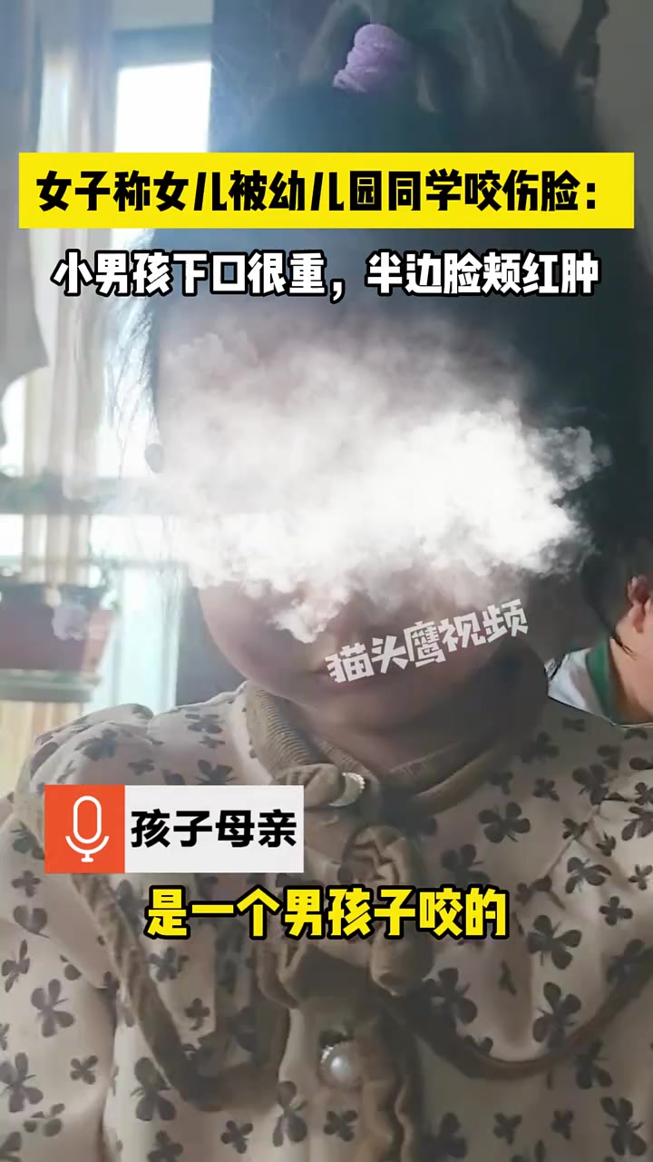 太气愤了！小女孩在幼儿园被男同学咬伤了