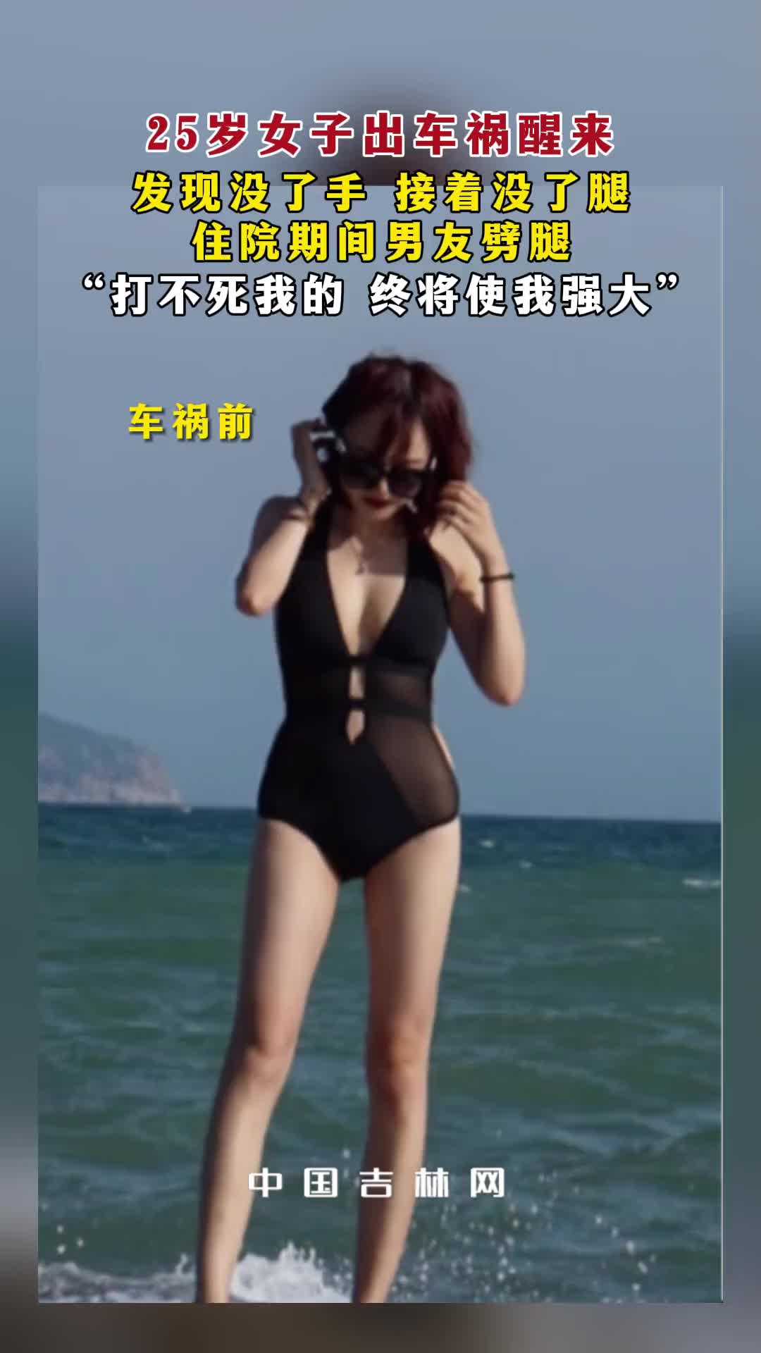女子车祸后没了一只腿一只手，还被劈腿！但她始终非常坚强！