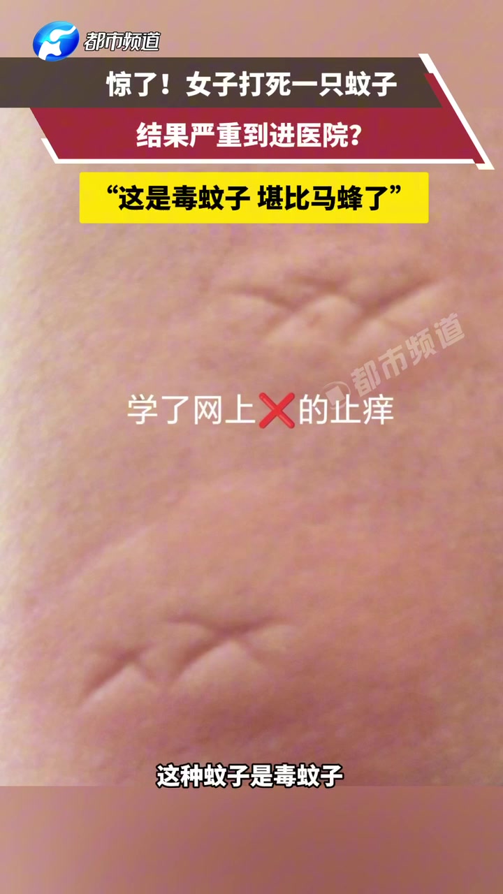 女子打死正在吸血的毒蚊子，结果被咬的地方肿了个大包要去医院