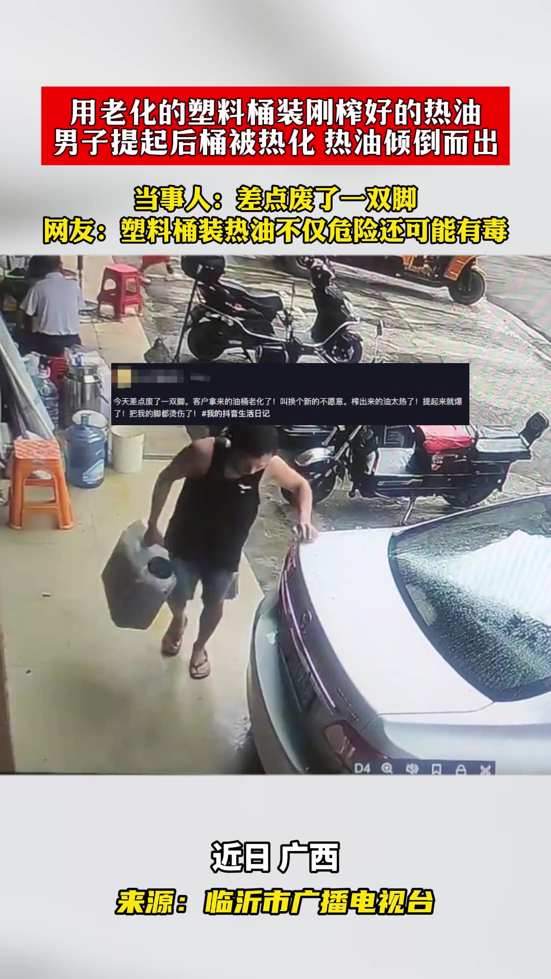 用老化的塑料桶装热油，结果桶坏了油洒到脚上