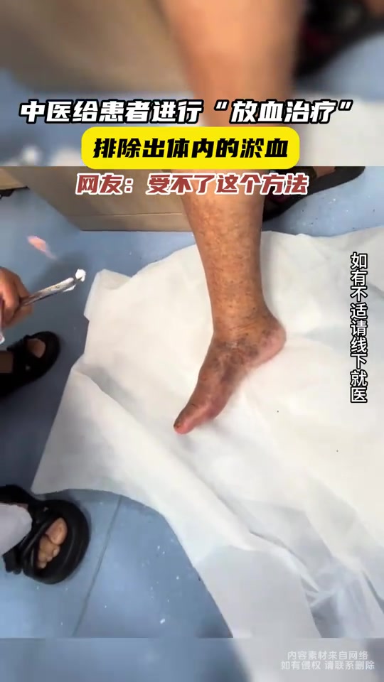 这个是“放血疗法”吗