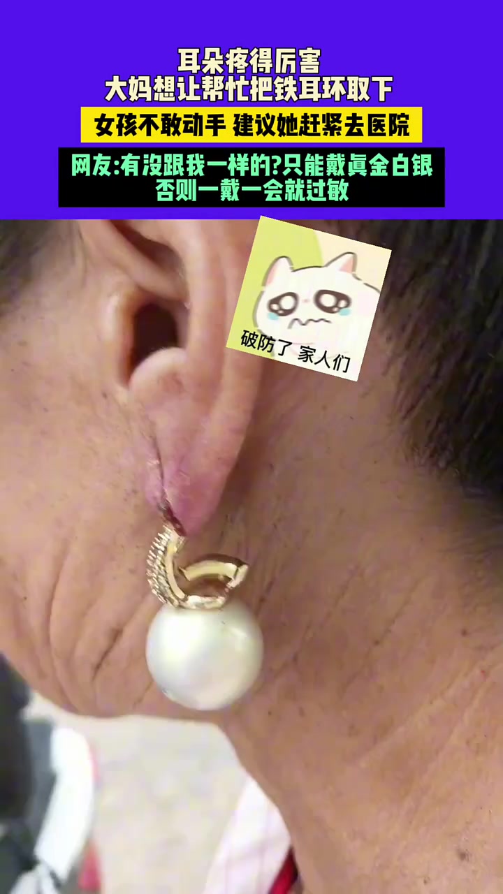 耳朵疼得厉害，大妈想让帮忙把铁耳环取下，女孩不敢动手