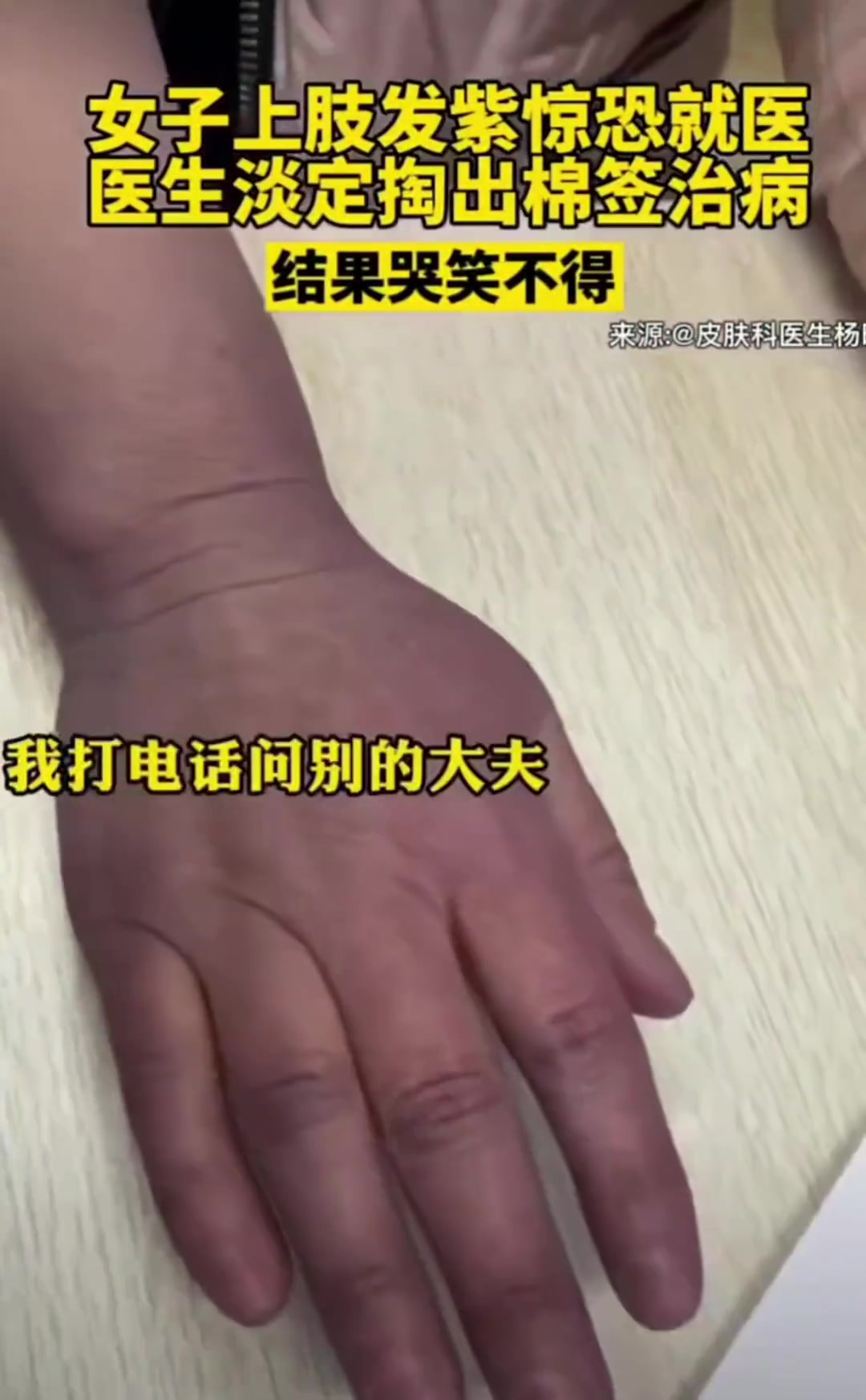 女子上肢发紫惊恐就医，医生淡定掏出棉签治病