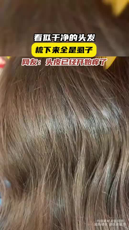 这是跑哪里去了能一头发全是这个玩意