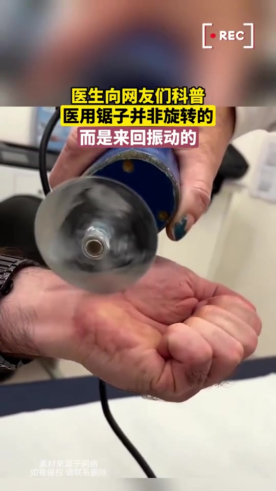 锯子割手无伤医用锯子并非旋转的，而是来回振动的！