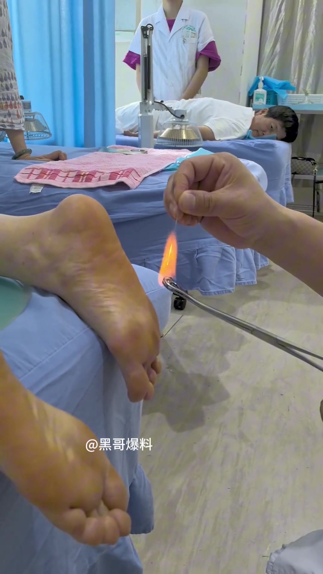 脚底针灸疗法，看着就疼！！但是有用！！