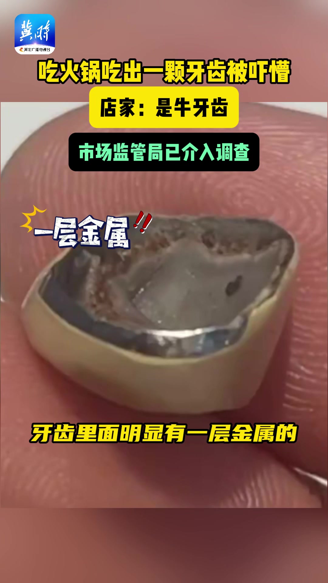 女子火锅吃出金属牙店家声称是牛牙！你们家的牛还做烤瓷牙