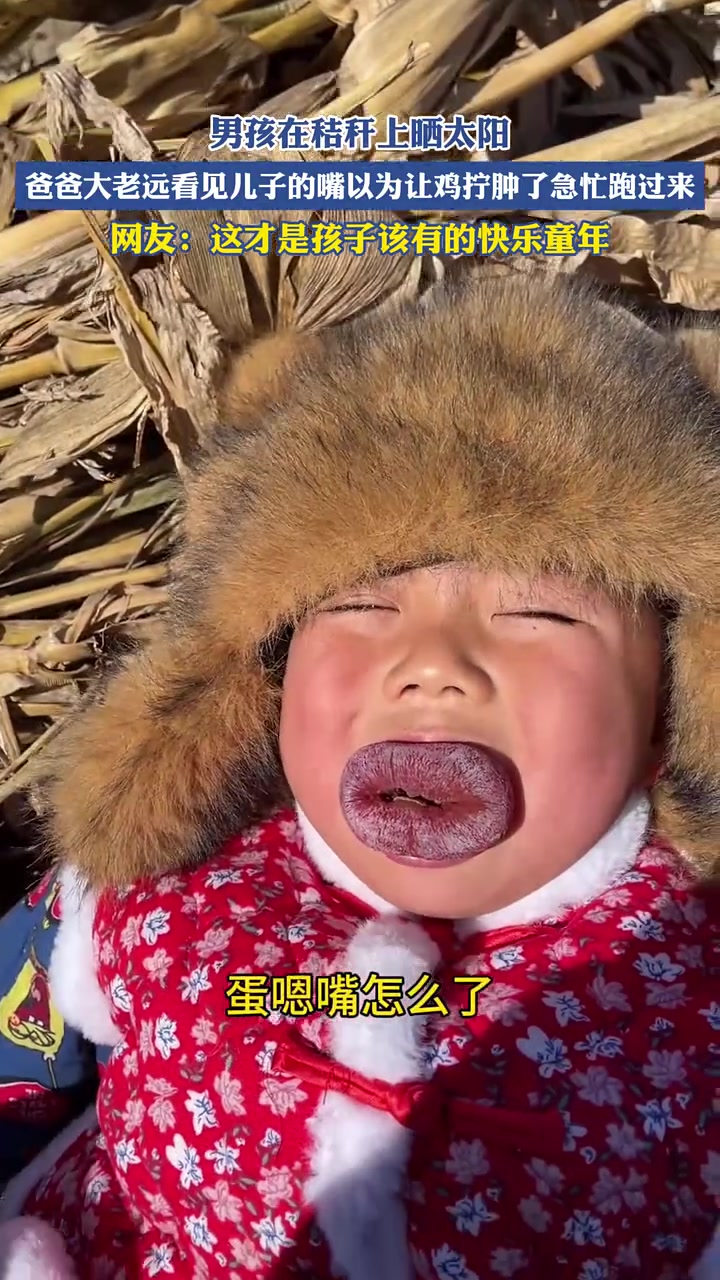 小孩肿成香肠嘴近看原来是......