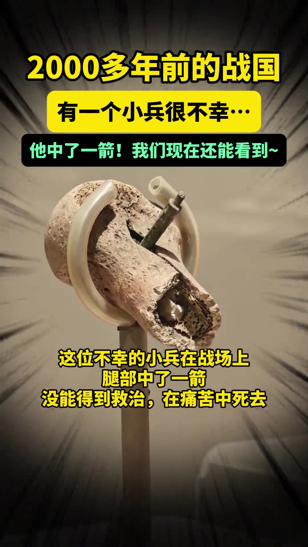 2000多年前的战国，有一个小兵很不幸他的腿上中了一箭