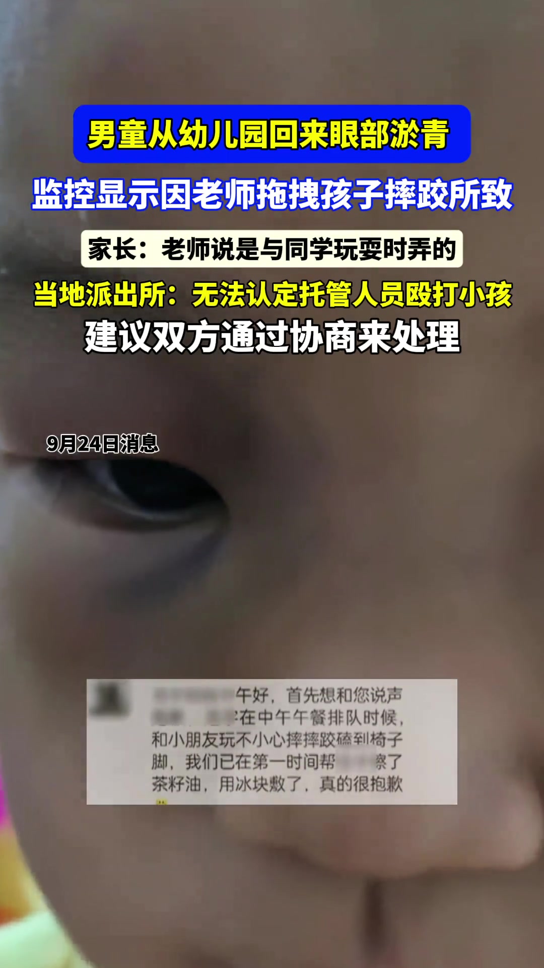 男童在托管机构被老师拖拽受伤，事后老师隐瞒事实！！！