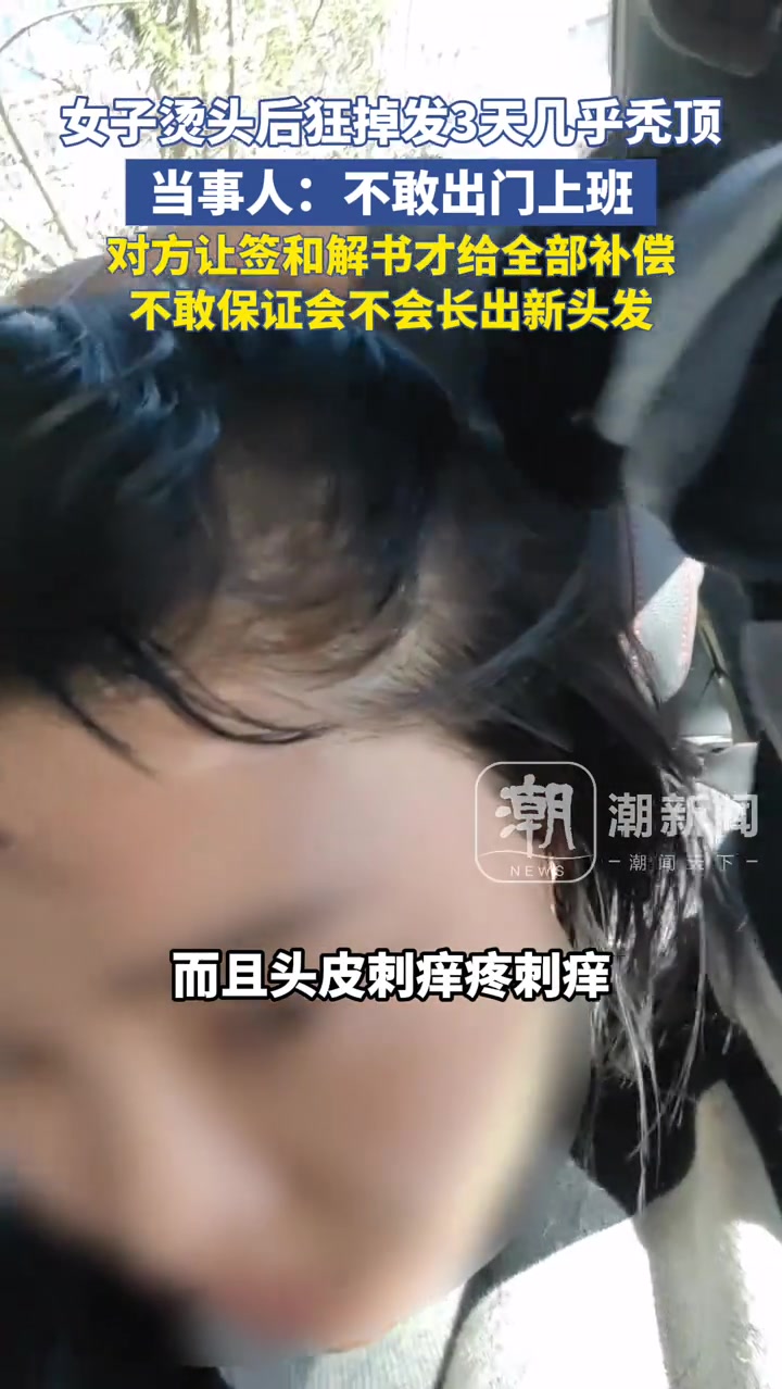 女子烫发后狂掉发，几乎秃顶