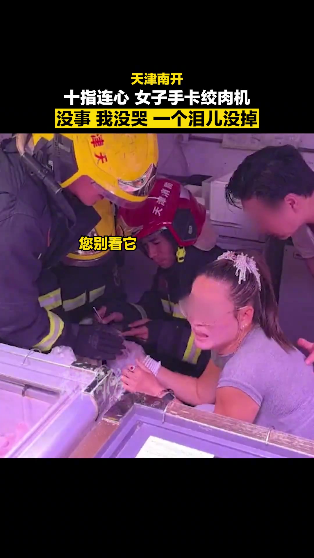 心态超好！女子手卡切片机忍痛拍照留念