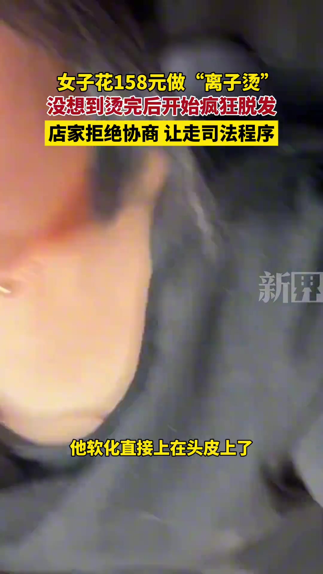 女子做“离子烫”没想到烫完后开始疯狂脱发店家拒绝协商