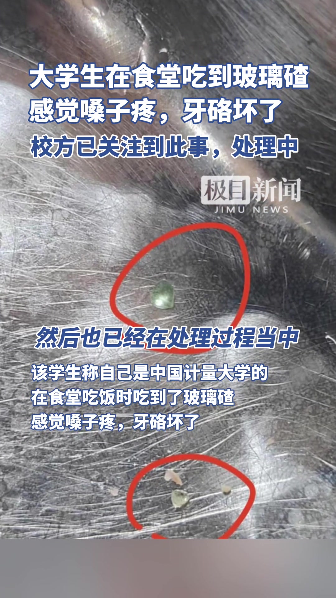 杭州一大学生在食堂吃到玻璃碴硌坏牙，校方：处理中