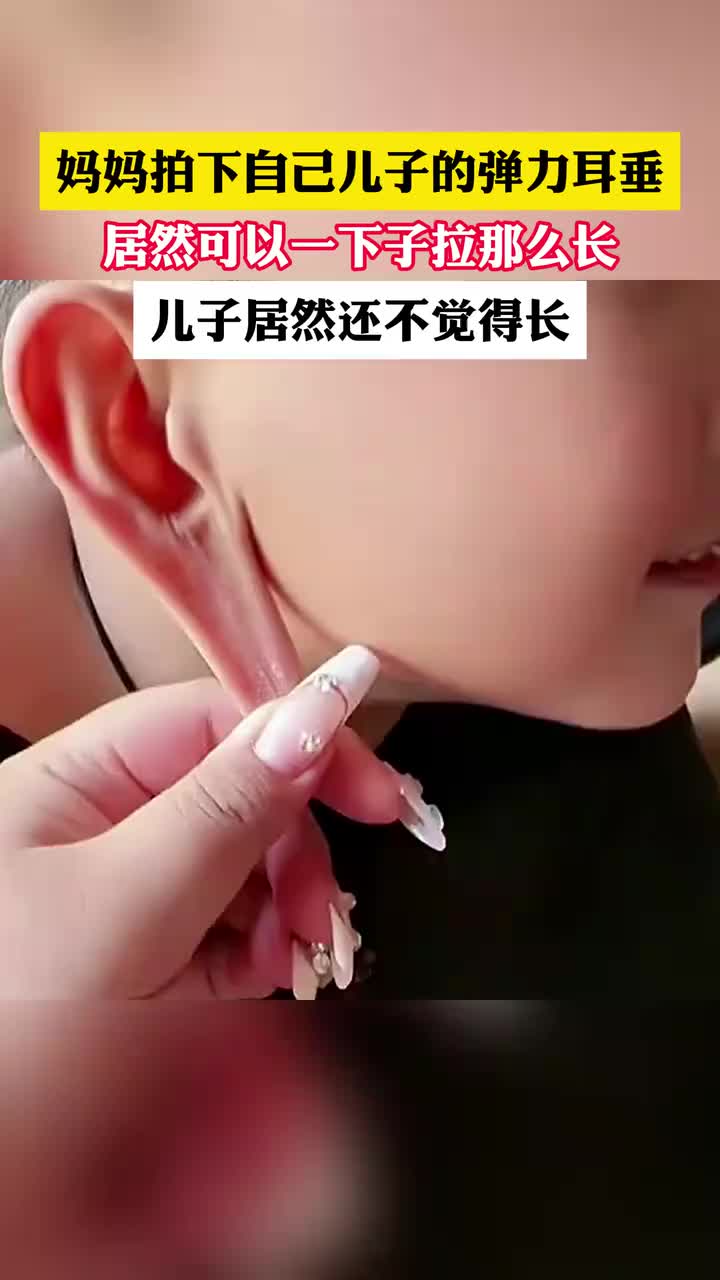妈妈拍下自己儿子的弹力耳垂，居然可以一下子拉那么长！