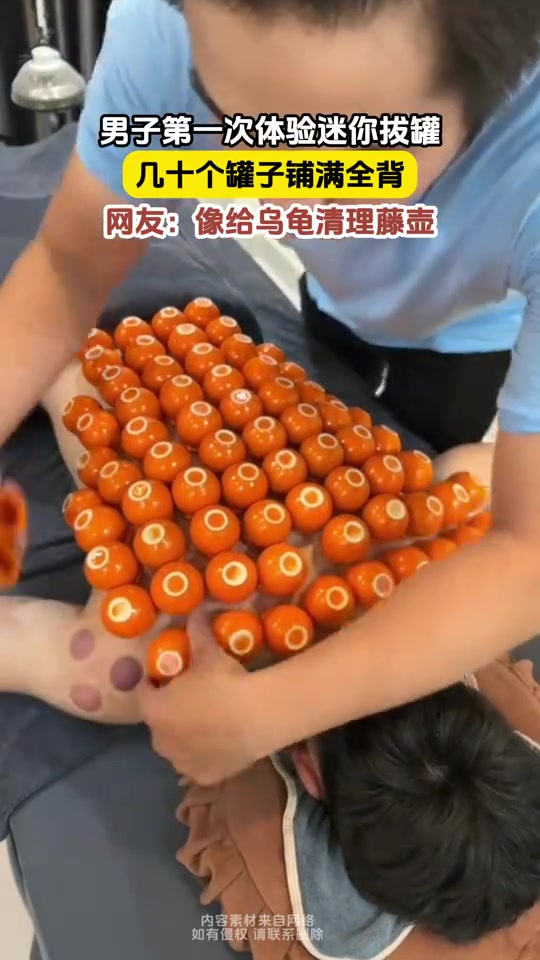 这哪是拔罐，这是给乌龟清理藤壶
