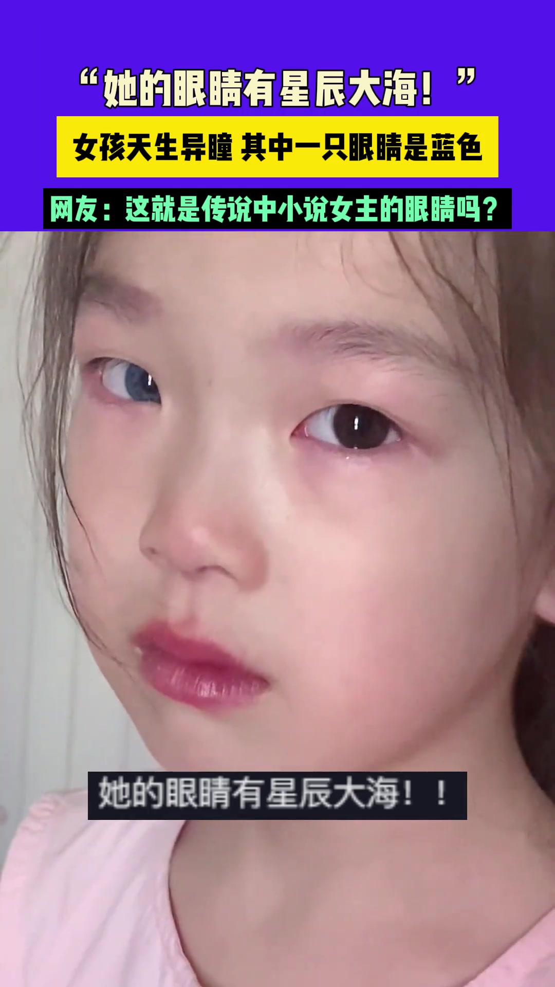 女孩天生异瞳，她的眼睛有星辰大海！