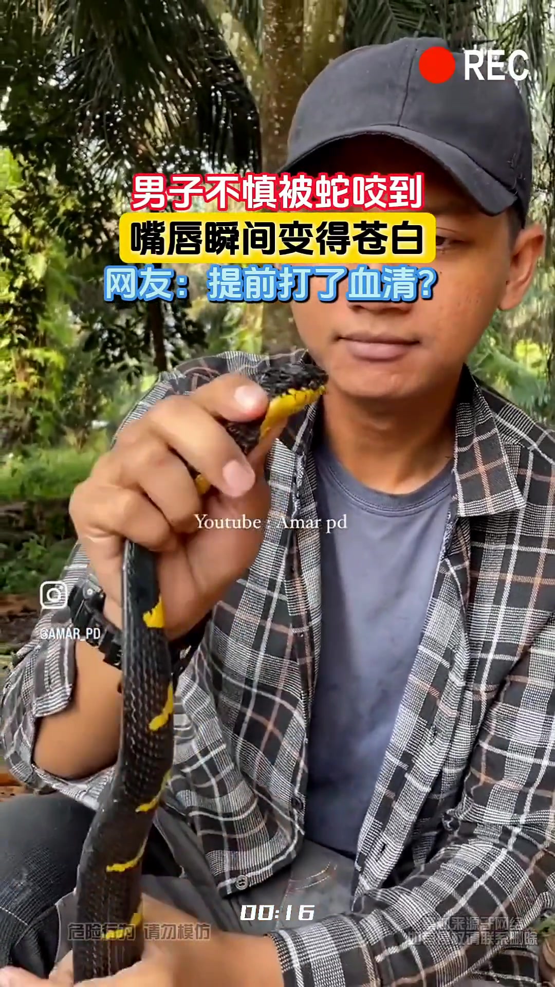 你小子是故意打了血清来逗蛇的吧