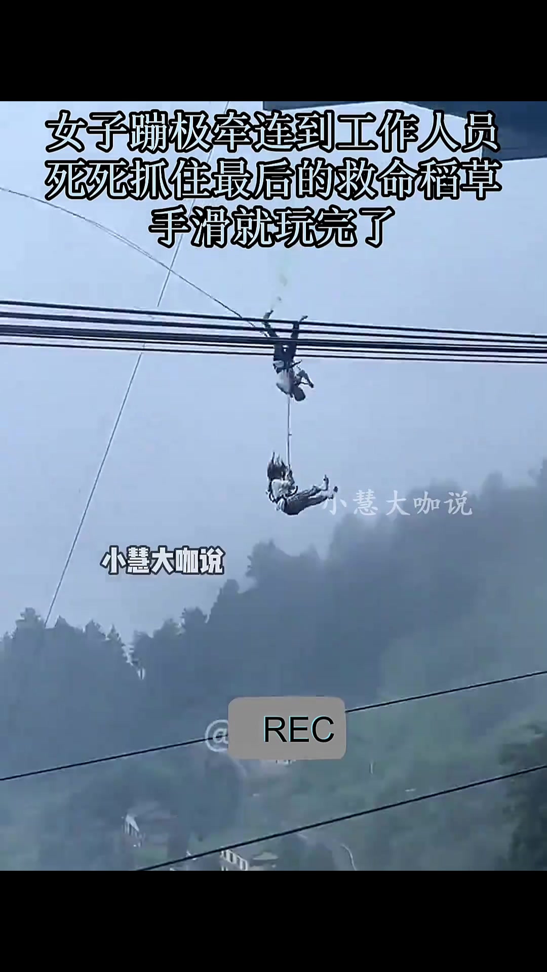 工作人员身心素质都很好啊！硬生生从阎王爷手里把命夺回来的